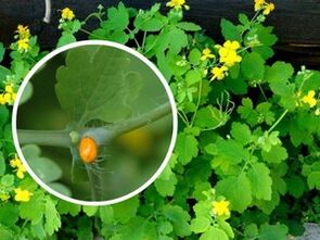 stinkende gouwe kruidensap voor de behandeling van plantaire wratten